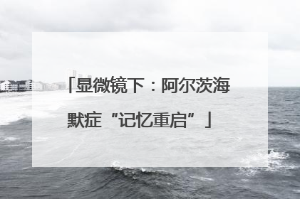 显微镜下：阿尔茨海默症“记忆重启”